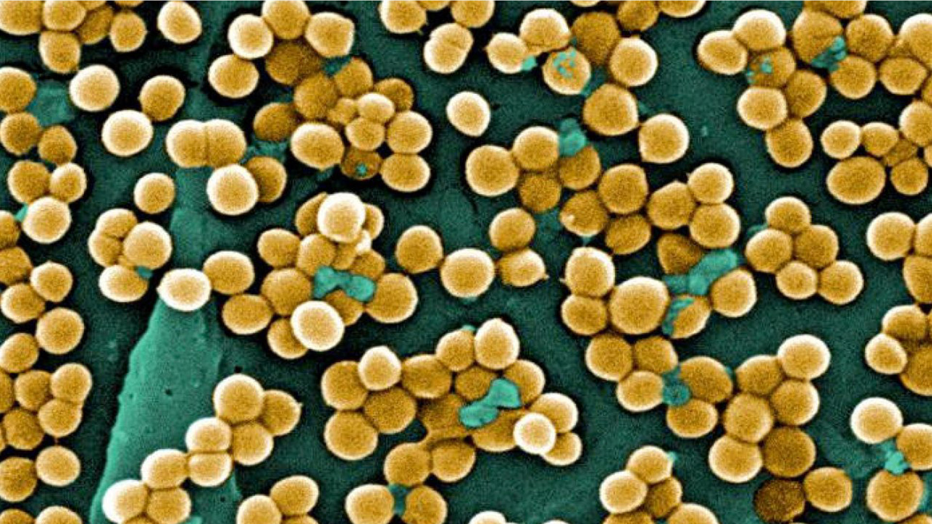 Las bacterias resistentes a los antibióticos: ¿motivo de la próxima gran pandemia?